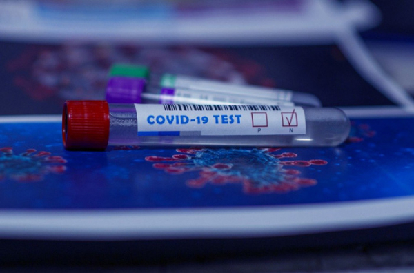 V Jihočeském kraji nově 14 případů COVID-19. Lidé si vozí infekci z dovolených